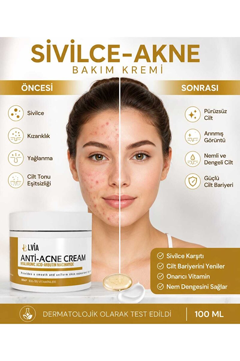 LVİA Vitamin İçeren Sîvîlce Önleyici Krem Siyah Nokta Sîvîlce - Âkne Karşıtı, Lèke Giderici Yüz Kremi