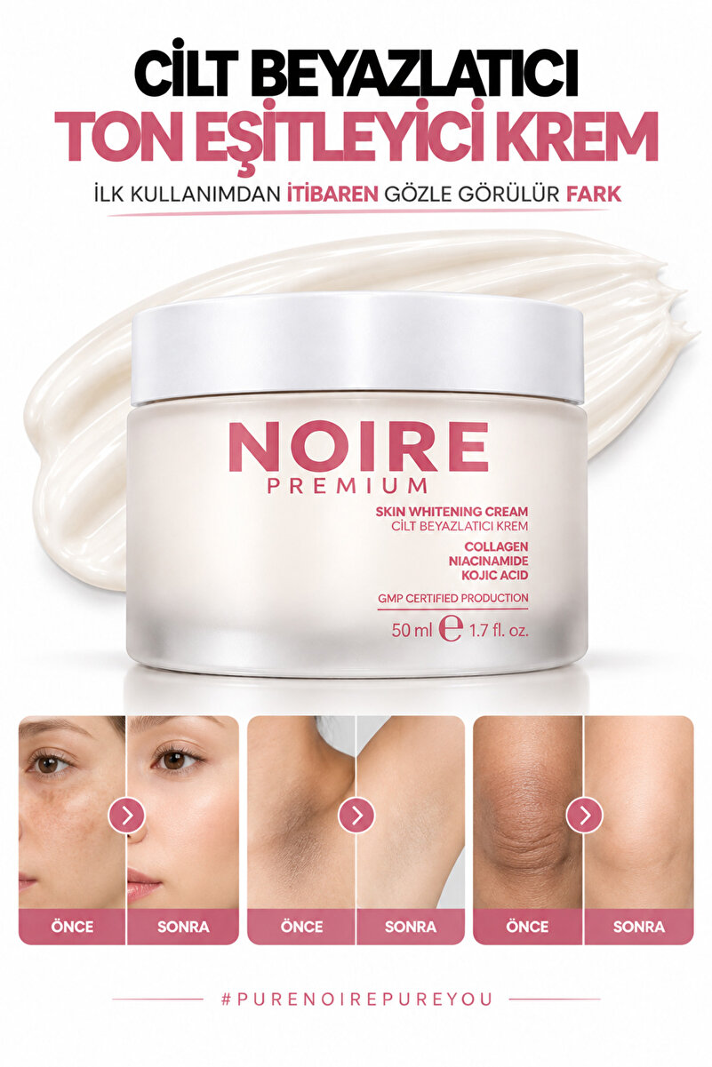 NOIRE PREMIUM Cilt Beyazlatıcı ve Ton Eşitleyici Krem Leke Karşıtı Glutatyon Arbutin Genital Bölge 50 ml