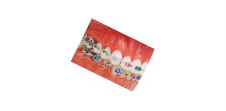 GC Dentalsepet Diş Teli Mumu Ortodontik Wax Fiyatları