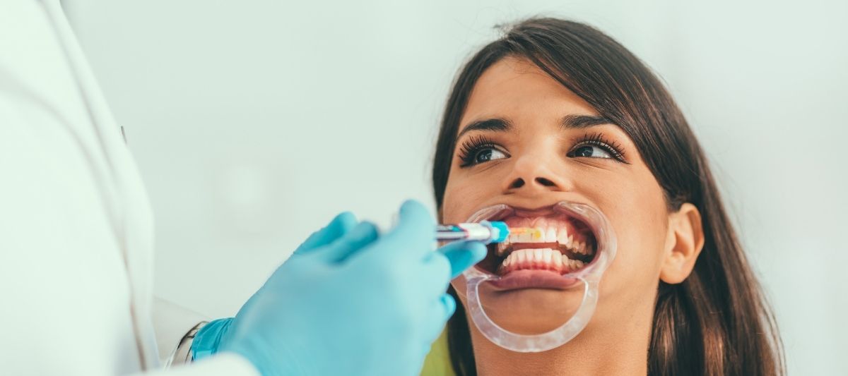 Diş Beyazlatma Yöntemleri Diş Yapısını Nasıl Etkiler?