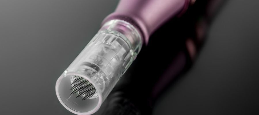 Dermapen Tedavisinin Aşamaları ve Süreci