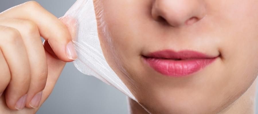 Farklı Kimyasal Peeling Seçenekleri ve Etkileri