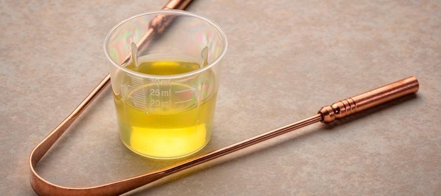 Oil Pulling Yaparken Dikkat Edilmesi Gerekenler