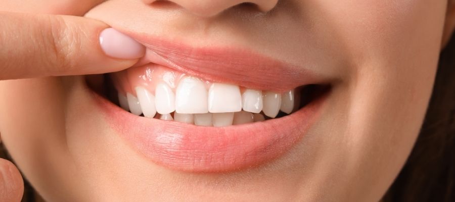 Evde Doğal Diş Eti Bakımı