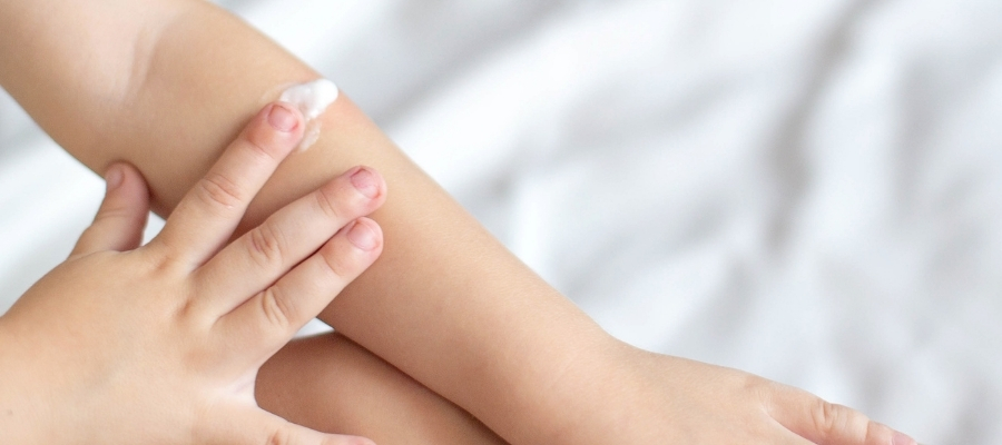 Bebek Cildi için Yanık Kremleri ve İçerikleri