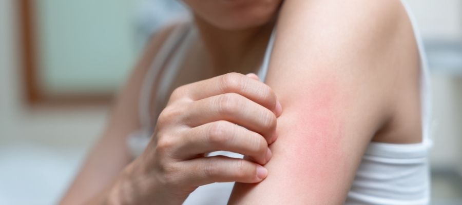 Cilt Problemlerinin Sinyali: Deri Döküntüsü Nedir?
