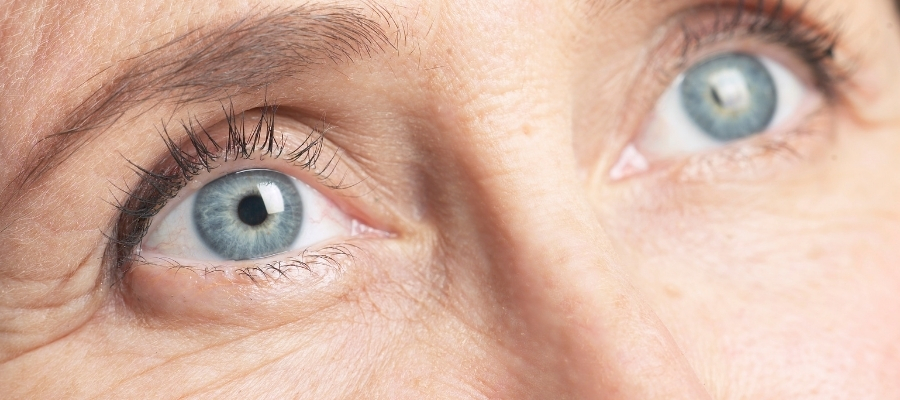 Kaz Ayaklarının Oluşum Sebepleri ve Önlenmesi