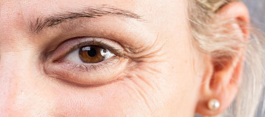 Kaz Ayaklarına Karşı Koruyucu Önlemler ve İpuçları