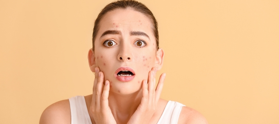 Ani Sivilce Artışı Neden Olur?