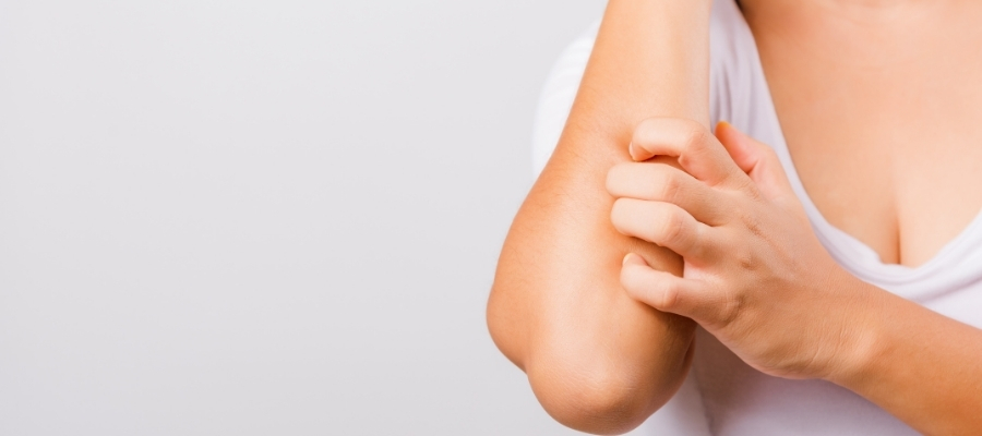 Kurdeşenin Belirtileri ve Nedenleri