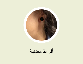 أقراط معدنية
