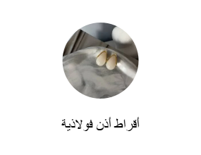 أقراط أذن فولاذية