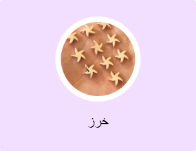 خرز