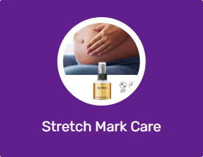 Stretch Mark Care