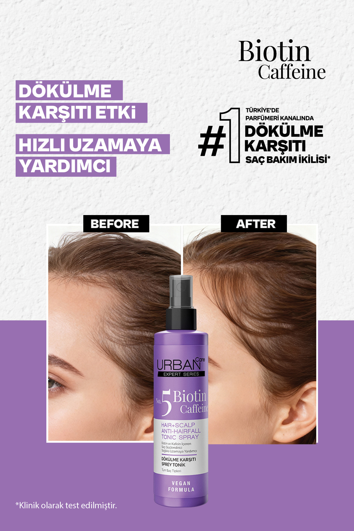 Expert Biotin ve Kafein Dökülme Karşıtı Şampuan&Tonik Set-vegan — SET.URB.8 — تصویر 5 از 8