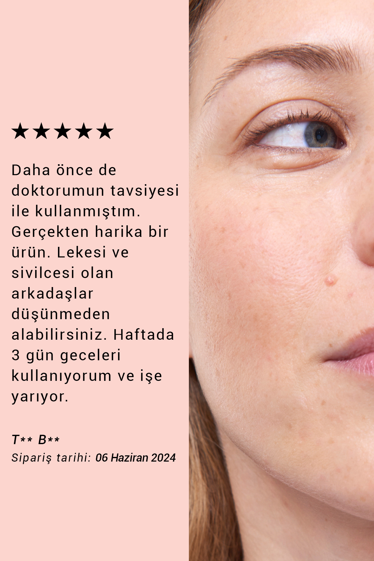 Pure Active Glikolik Asit %10 Aha Peeling Cilt Yenileme Etkili Saf Konsantre Cilt Bakım Serumu 15 ml — 7777200020352 — تصویر 8 از 9