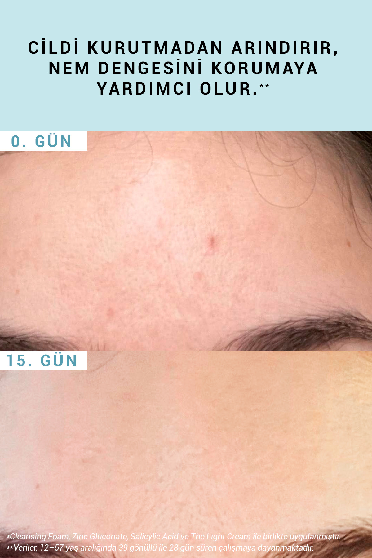 The Cleansing Foam Tüm Ciltler İçin Nazik Arındırıcı ve Yumuşatıcı Yüz Temizleme Köpüğü 150 ML — 3002091456 — تصویر 7 از 9