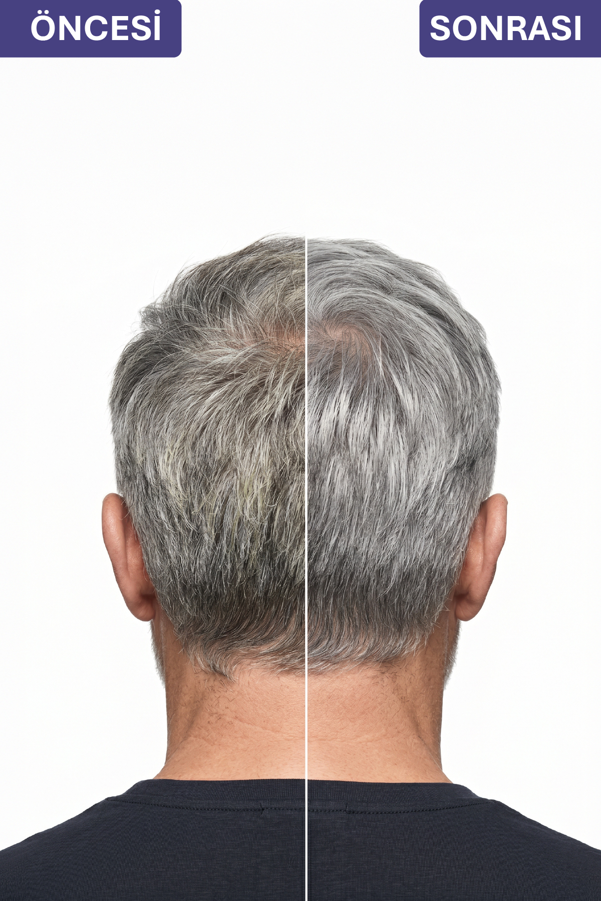 Mor Şampuan 250ml Platin, Sarı Saçlar İçin Turunculaşma Karşıtı Keratin İçerikli Parabensiz Silver — AJ.01.00010 — تصویر 7 از 9
