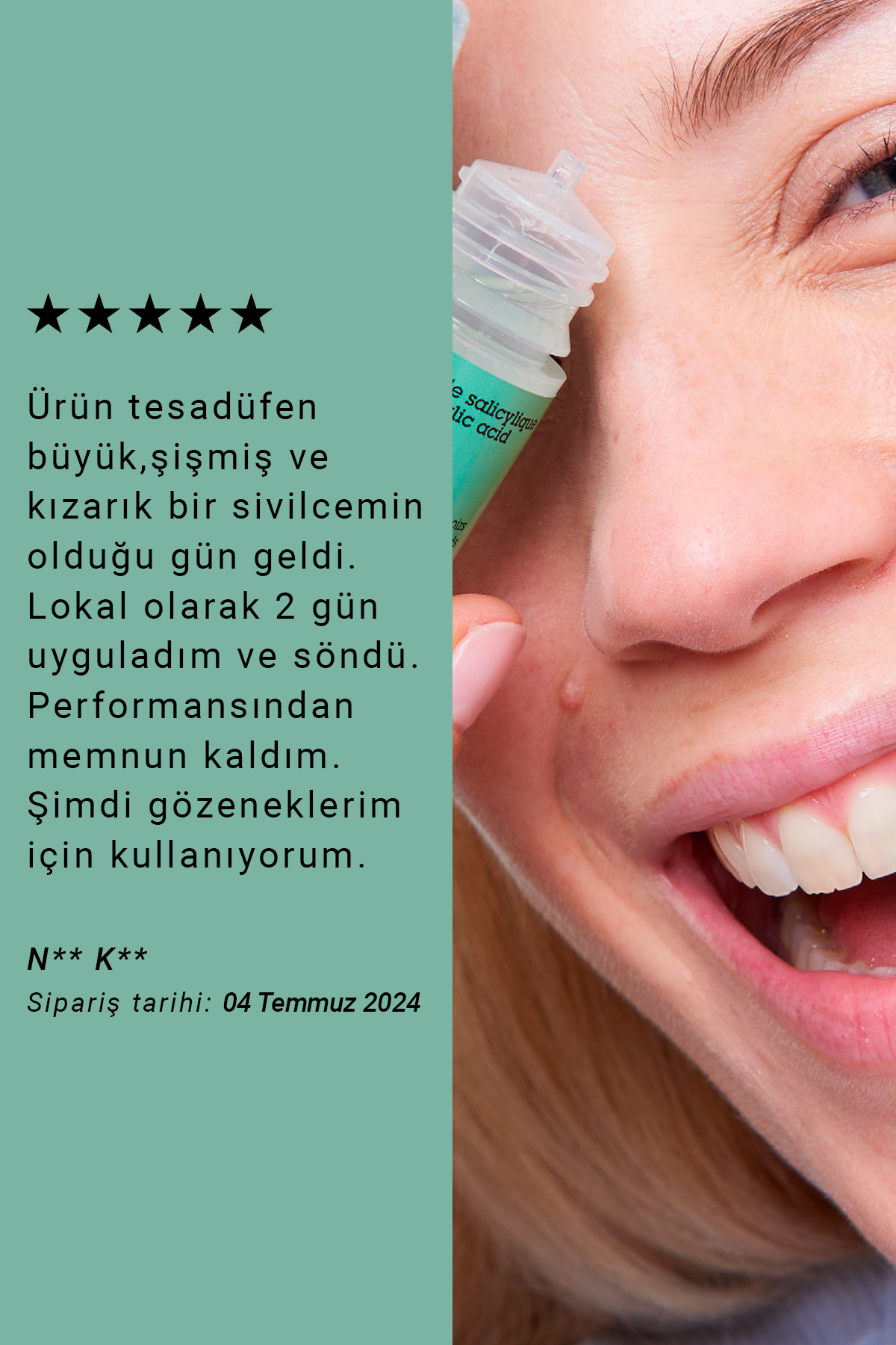 Siyah Nokta ve Karşıtı Bakım Seti — 1007653876 — تصویر 7 از 10
