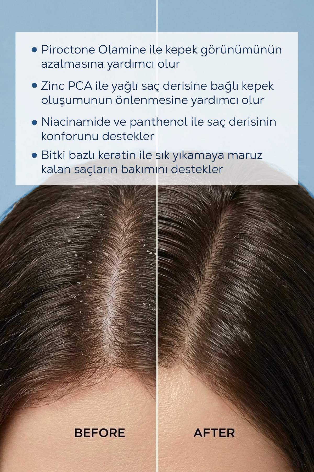 Dandruff Control Kepekli Saçlar için Şampuan — 34074 — تصویر 5 از 7
