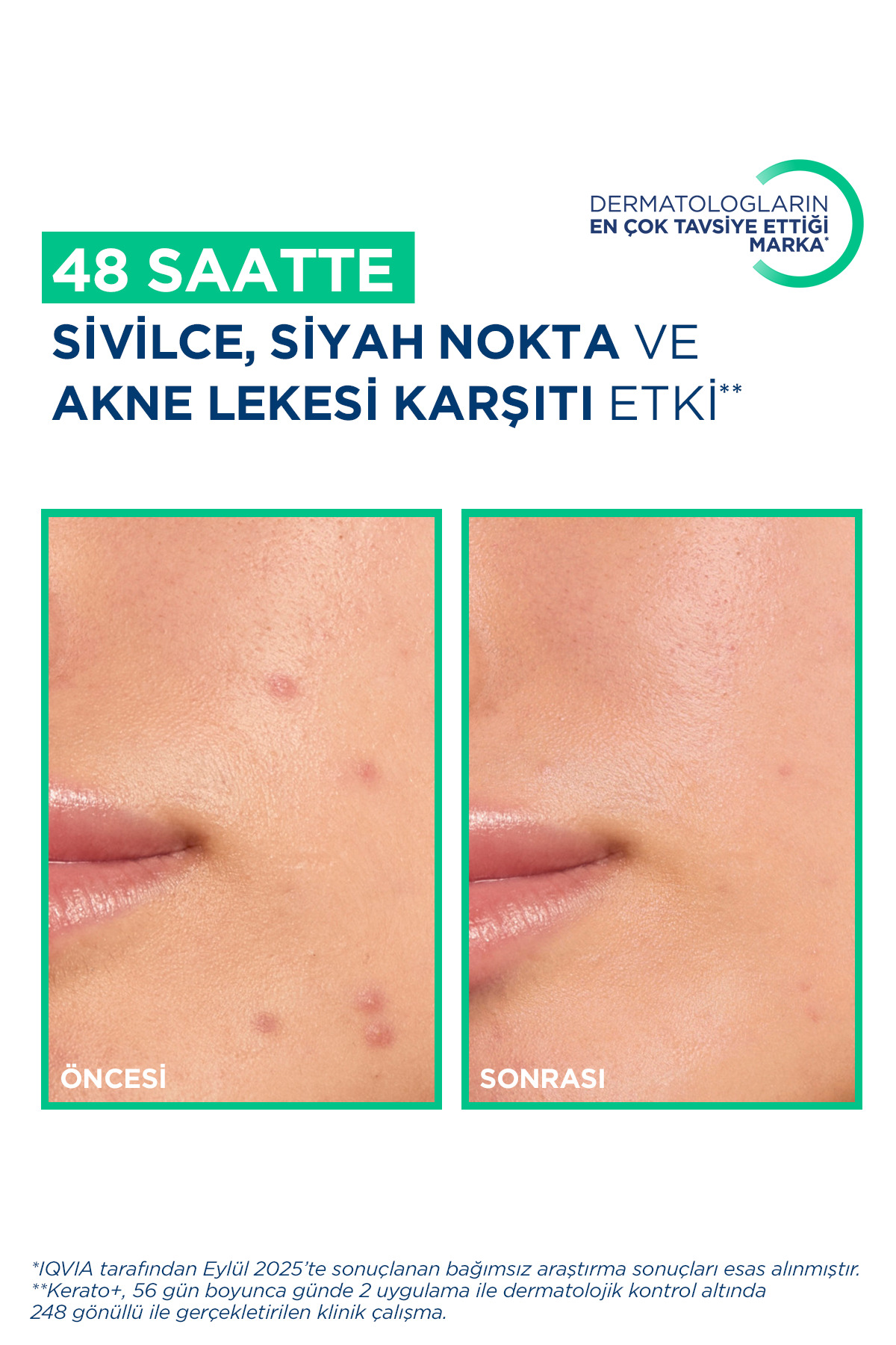 کرم ژل کراتو سبیوم 30 میلی لیتر — 1002305367 — تصویر 8 از 8