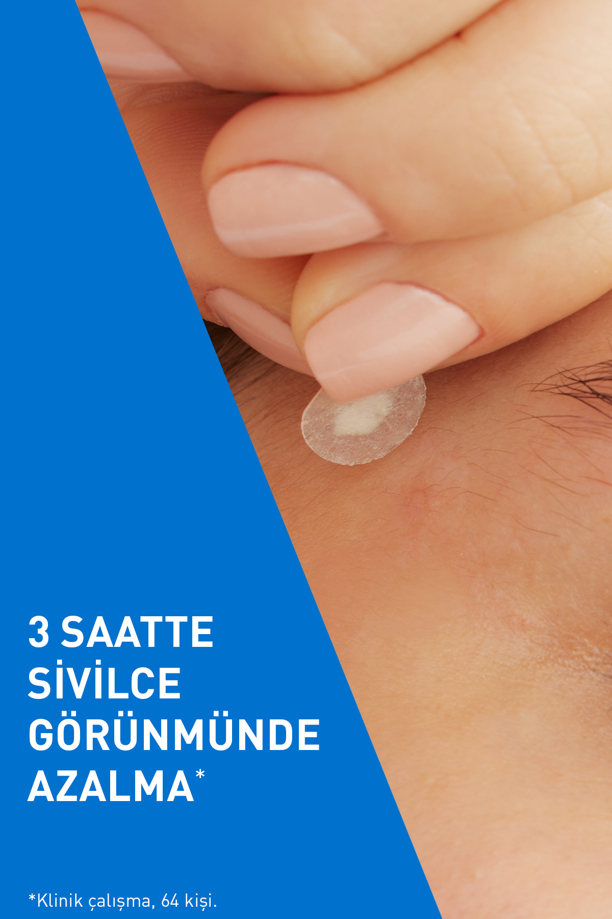 Salisilik Asit & Seramid İçerikli Sivilce Karşıtı Bant 22 adet + TELEFON VANTUZU HEDİYELİ! — 217321732173 — تصویر 5 از 8