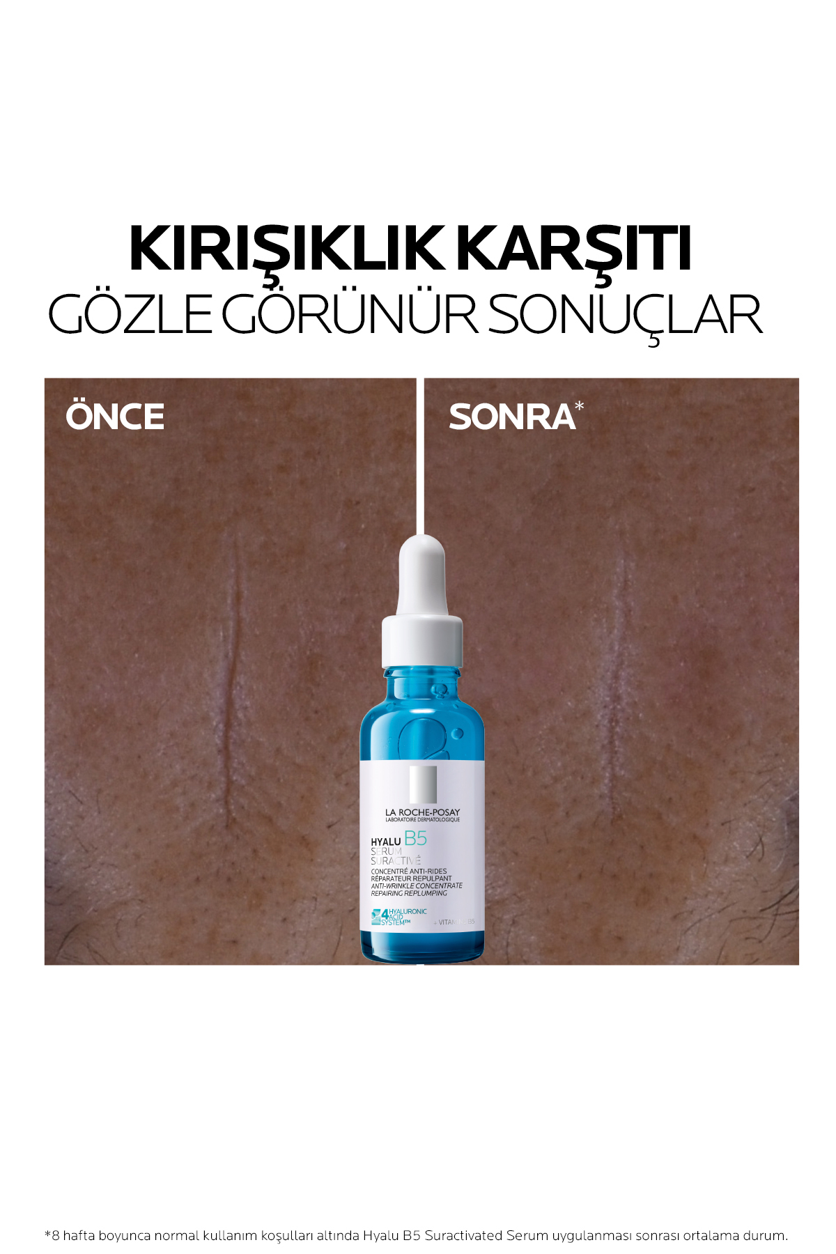 Hyalu B5 Hyalüronik Asit& Vitamin B5 İçeren Kırışıklık Karşıtı Onarıcı ve Dolgunlaştırıcı Serum 30ml — LRP583626 — تصویر 4 از 9