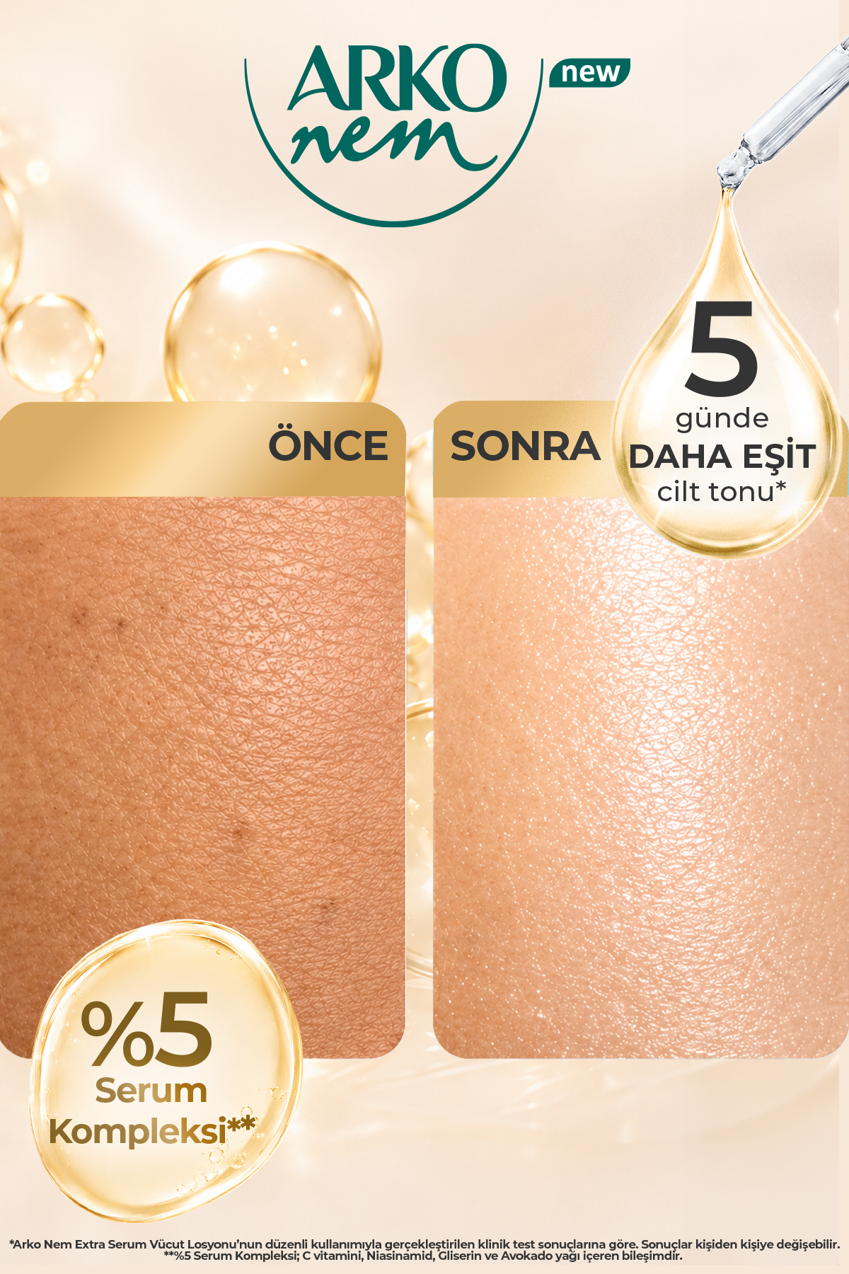 Extra Serum Leke Karşıtı & Ton Eşitleyici Vücut Losyonu 200 Ml — 8690506567101 — تصویر 5 از 6