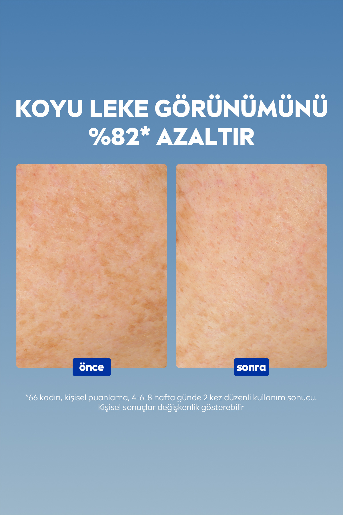 سرم ضد لک پوست Luminous630، 30 میلی لیتر، مخصوص پوست های لک دار — 82616-08200-09 — تصویر 12 از 12