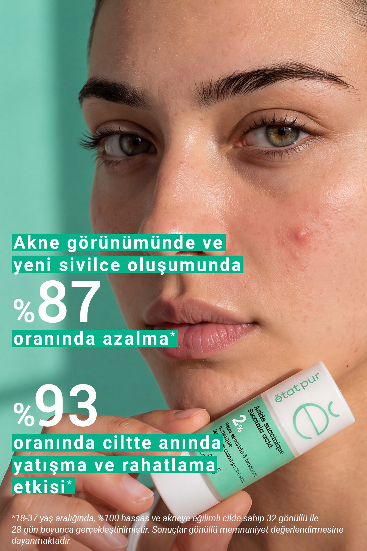 Pure Active Süksinik Asit %2 Hassas Ciltler için Akne ve Leke Karşıtı Konsantre Bakım Serumu 15 ML — 3001315652 — تصویر 6 از 10