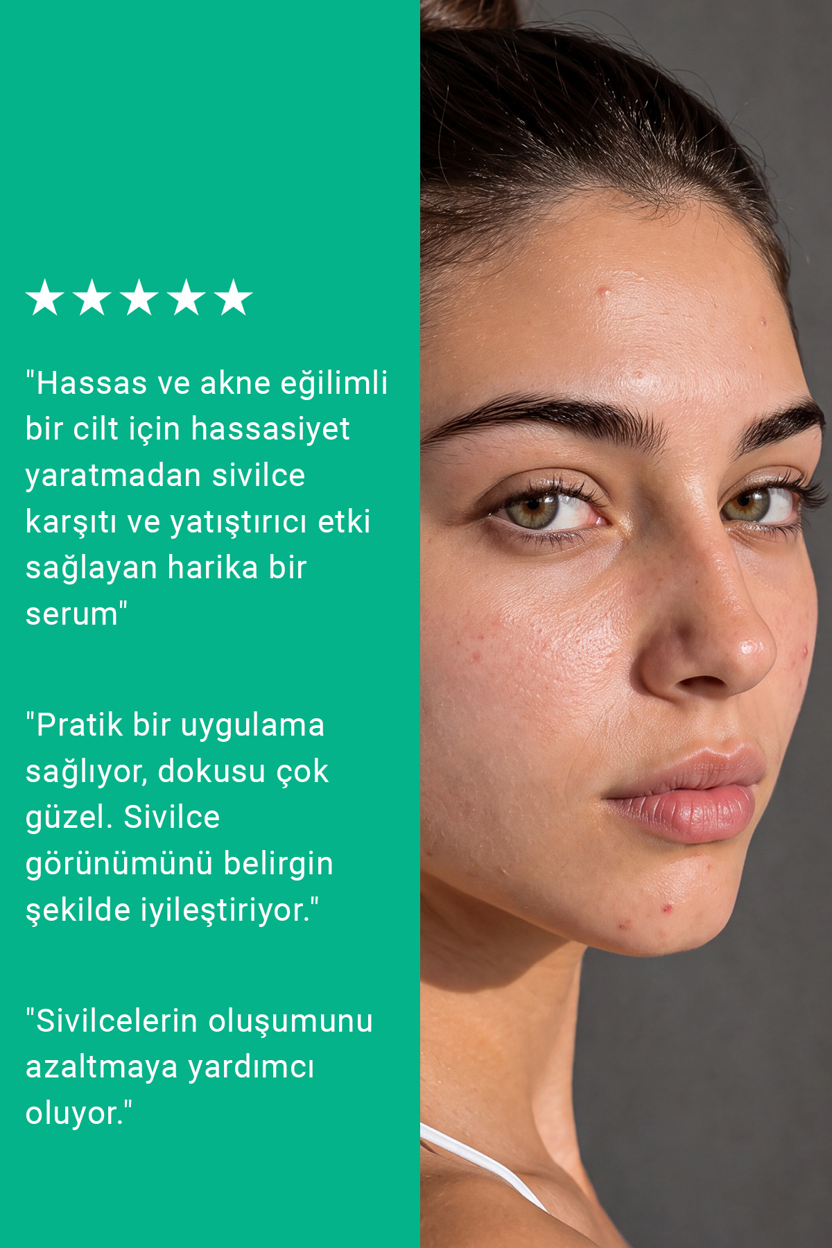 Pure Active Süksinik Asit %2 Hassas Ciltler için Akne ve Leke Karşıtı Konsantre Bakım Serumu 15 ML — 3001315652 — تصویر 7 از 10