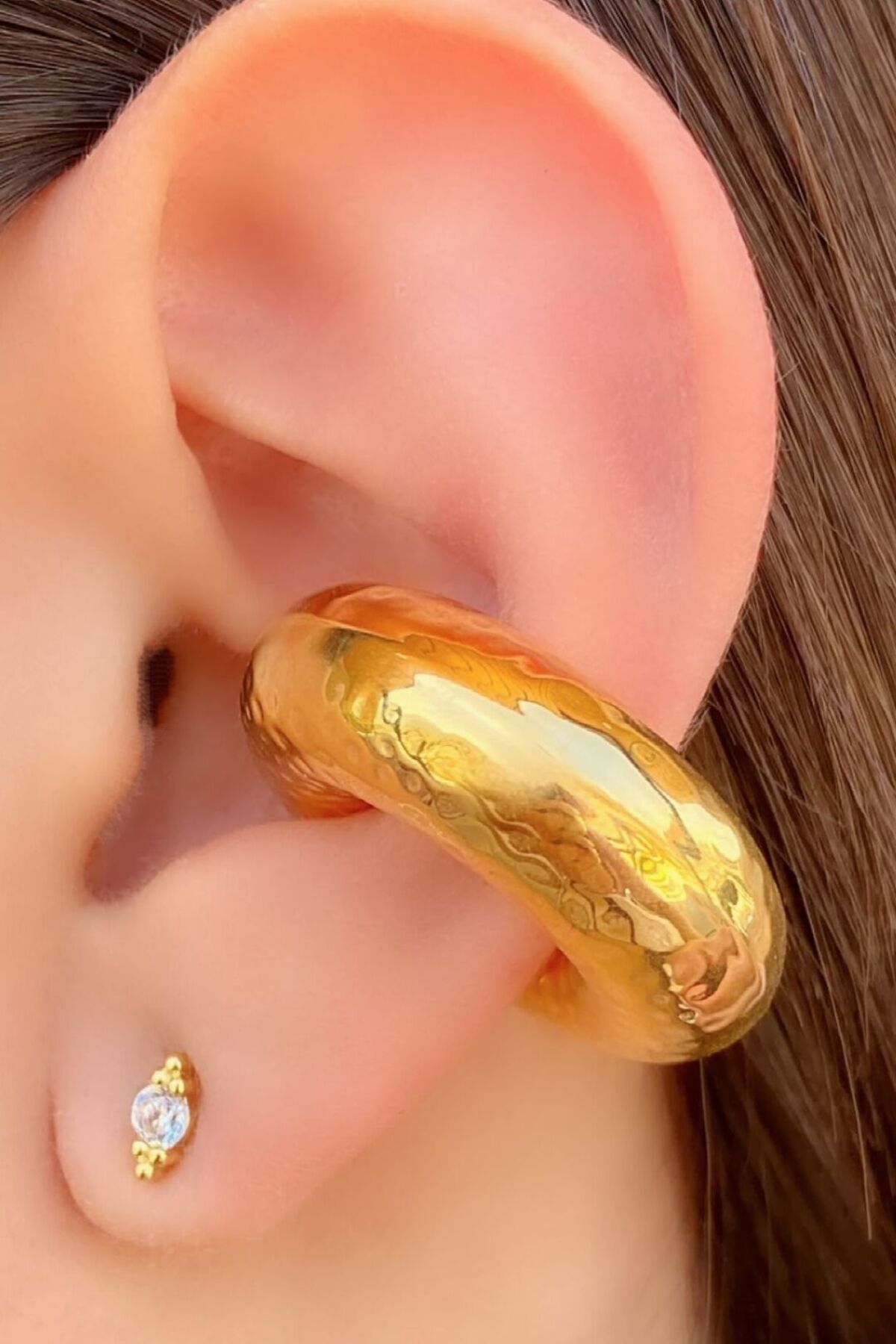 Large clearance cartilage hoop