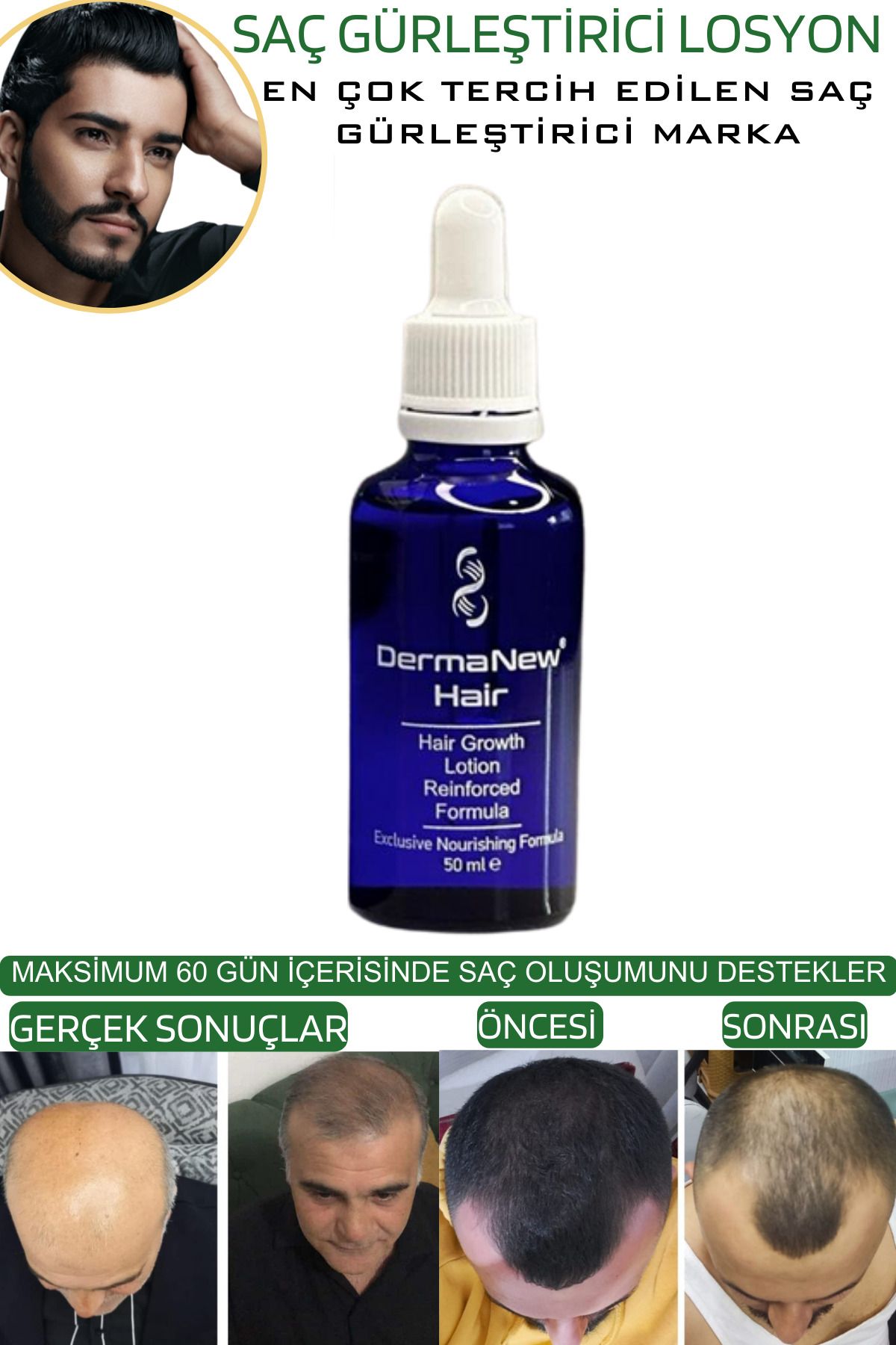 https://cdn.dsmcdn.com/ty1034/product/media/images/prod/PIM/20231106/14/f74aabb5-30de-4e6e-abca-630074d1b0d3/1_org_zoom.jpg