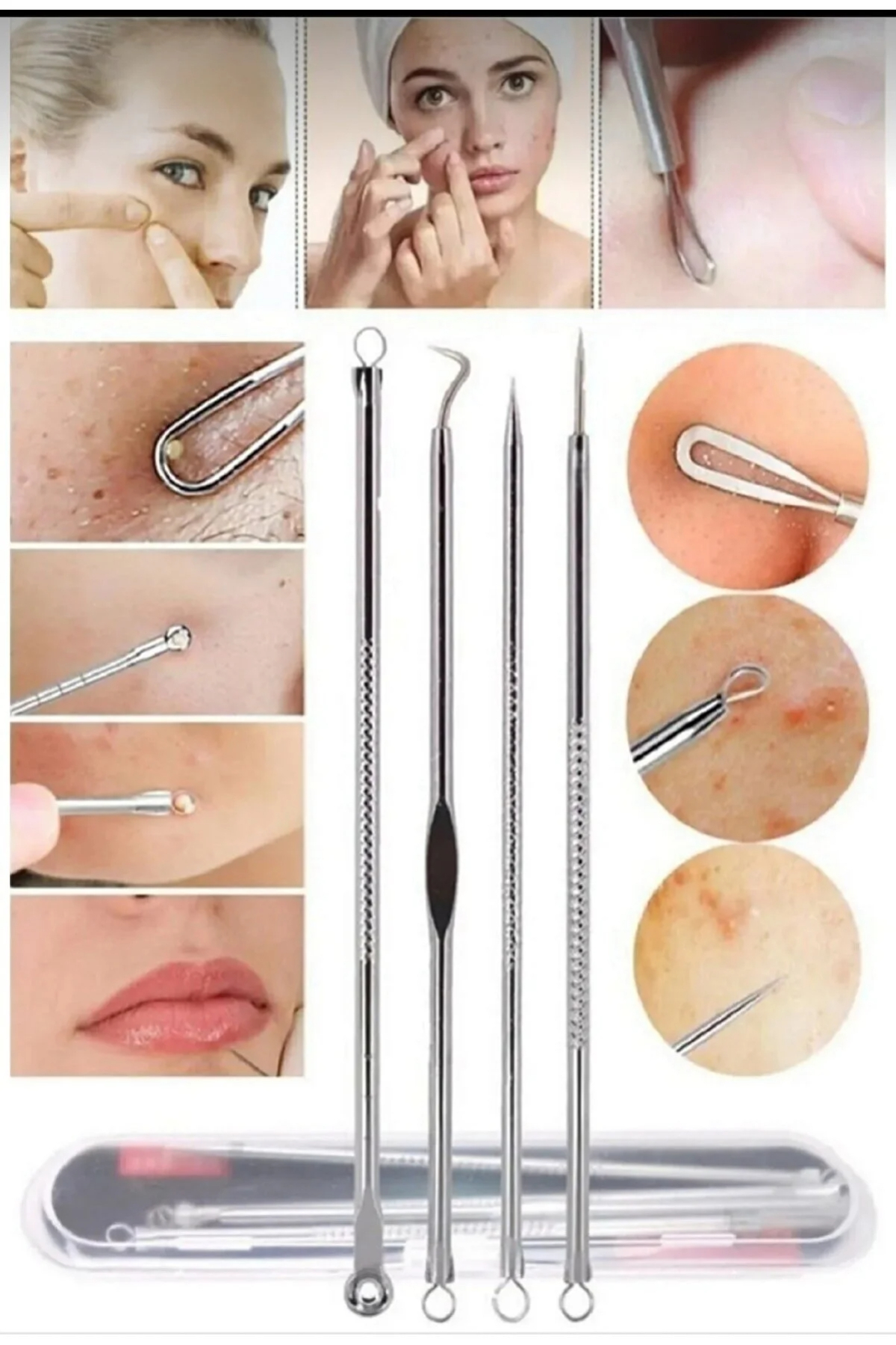 ست ۴ تکه سوزن نقره‌ای مخصوص جوش‌های سرسیاه کومدون، داخل جعبه — UR51435 — تصویر 7 از 9
