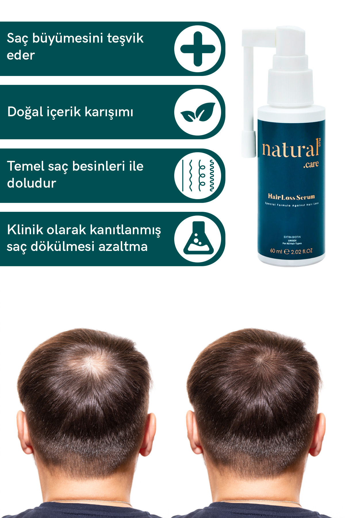 Saç Serumu - Önleyen Ve Uzama Sürecini Destekleyen Özel Formül Procapil Biotin 60 ml — NC202 — تصویر 3 از 4
