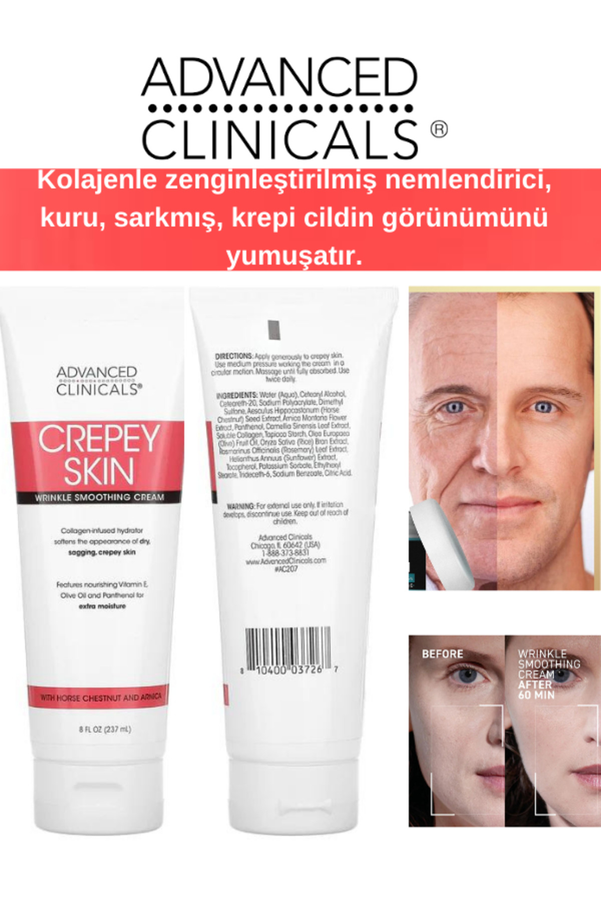 Advanced MD Advance Clinicals,Crepey Skin, Kırışıklık Düzleştirici Krem