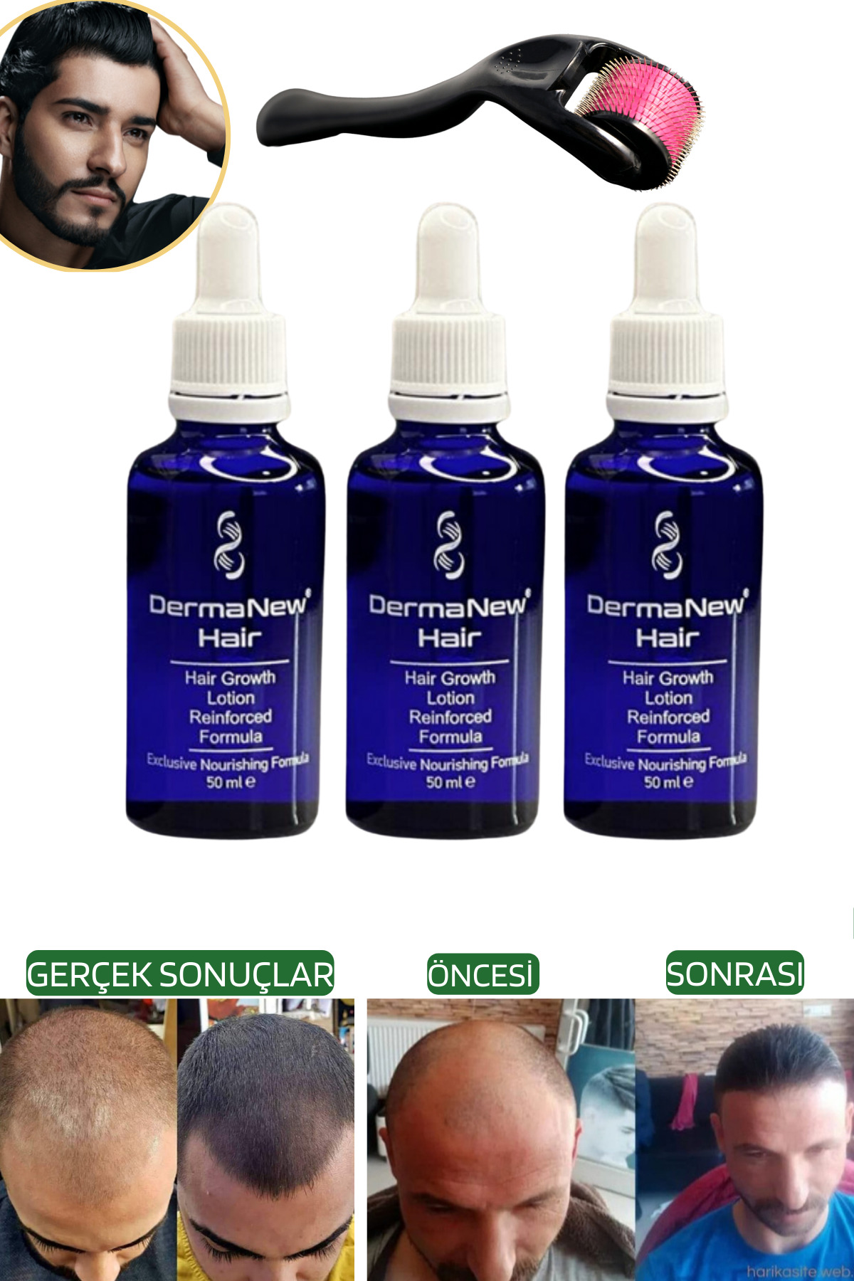 dermanew hair Dermanew Sac Serumu - Sac Bakimi Hair Lotion / 3 Serum Roller