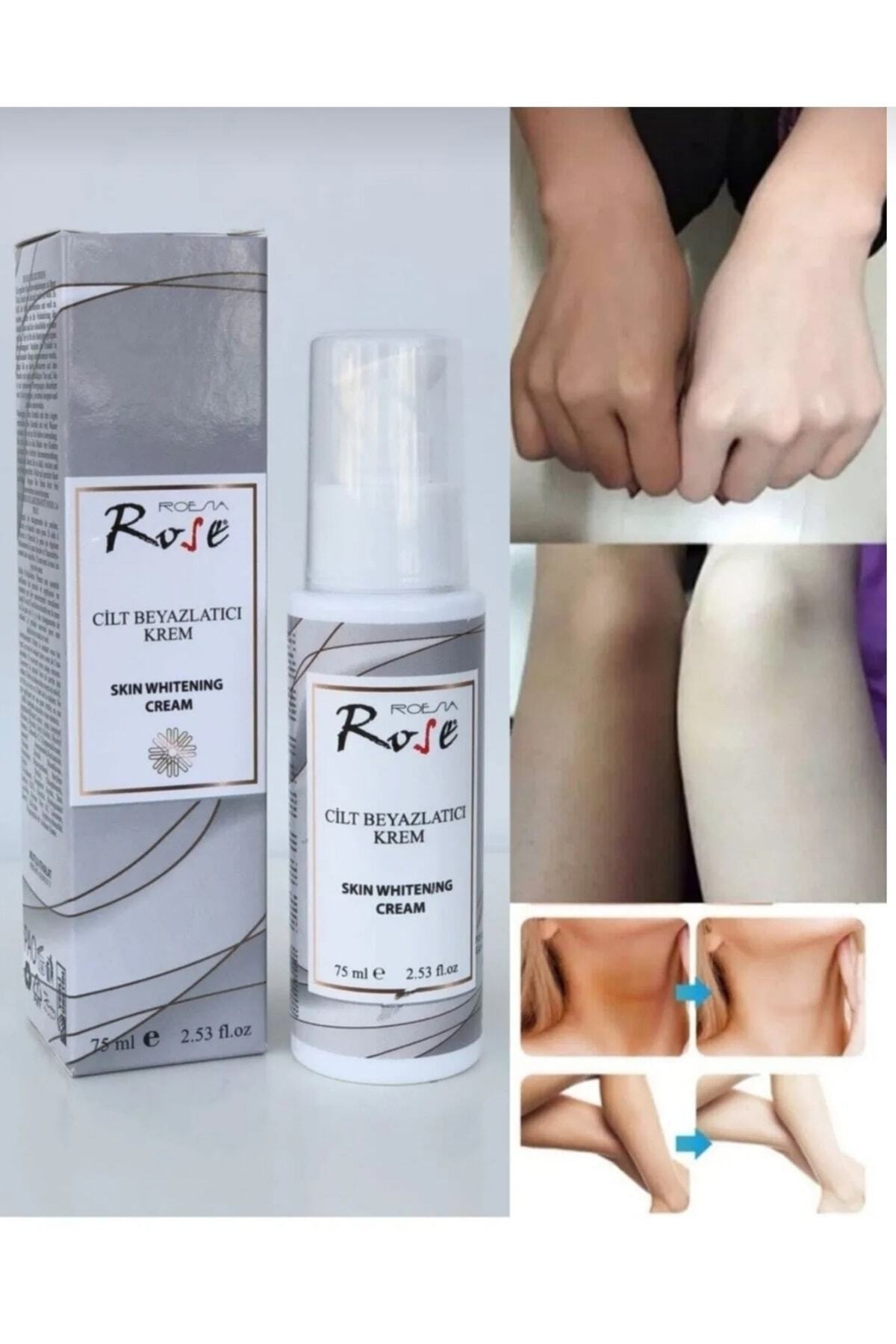 ASTER BEAUTY Rose Cilt Beyazlatıcı Krem 75 ml