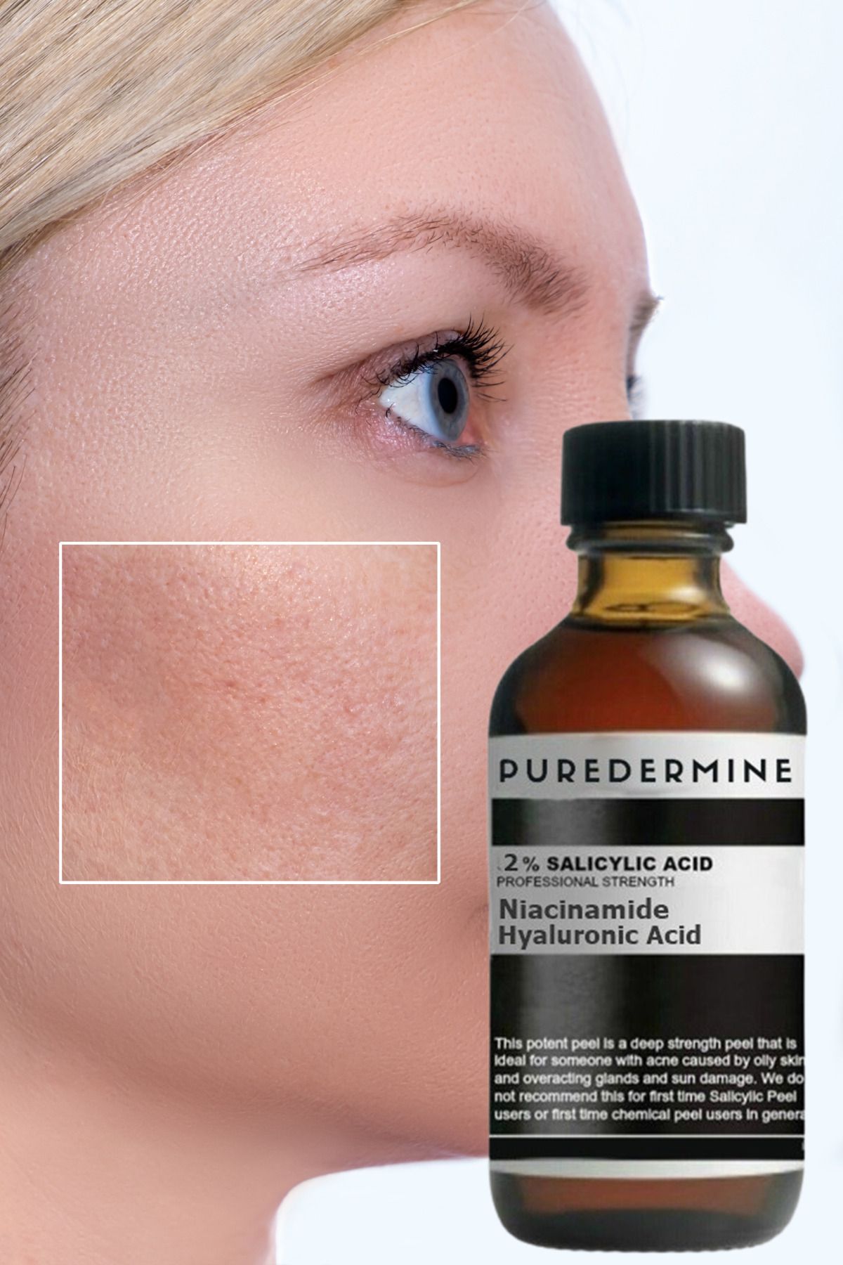 Puredermine-Salicylic Acid & Dull Clogged Pores & Blackhead & Acne Serum & Niacinamide + Ha 2
