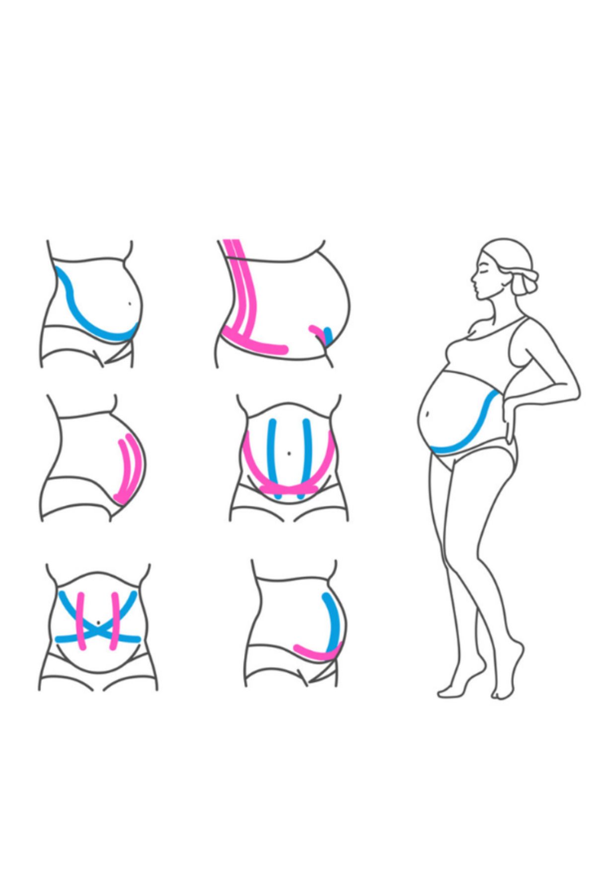 VZN-Belly for Pregnancy Pain - Back Support Band Skin 2