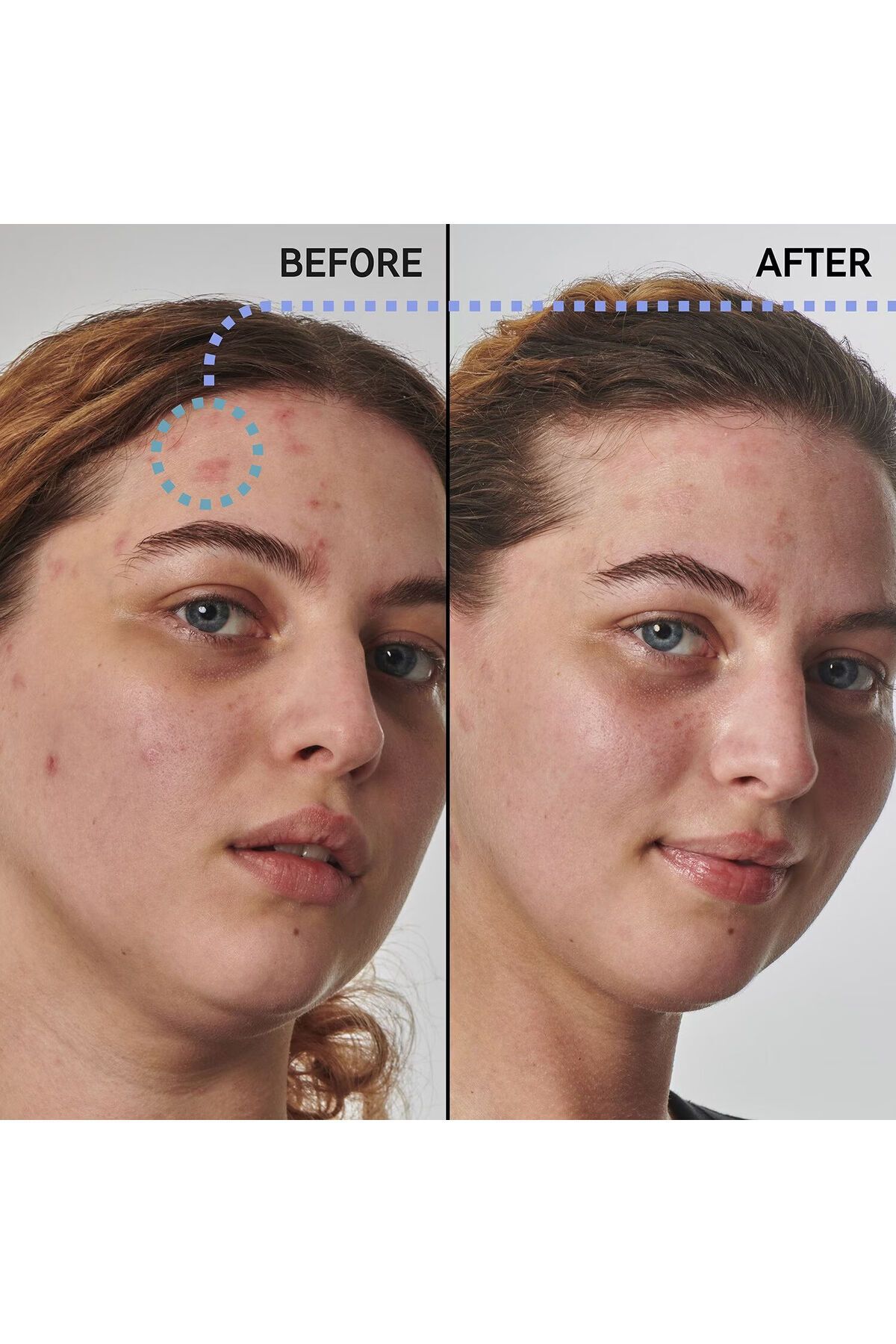 THE INKEY LIST-DRY AND ROUGH SKIN SLUTION WITH 10% UREA REVITALIZING FACIAL SERUM 50 ML SHTTNG42 2