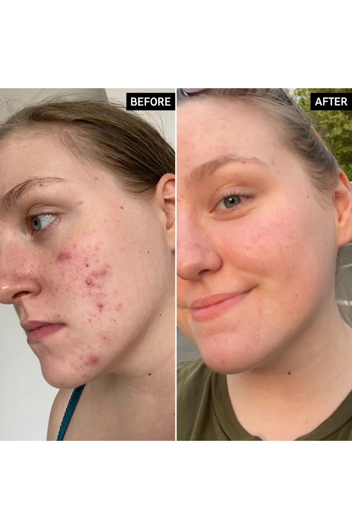 THE INKEY LIST-Vitamin C 15% and Egf Serum 30 ml 3