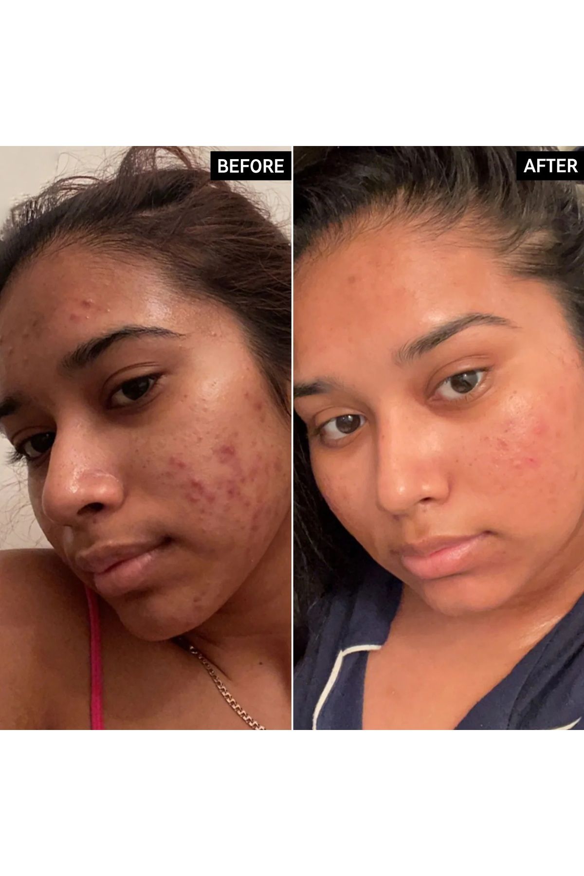 THE INKEY LIST-Vitamin C 15% and Egf Serum 30 ml 2
