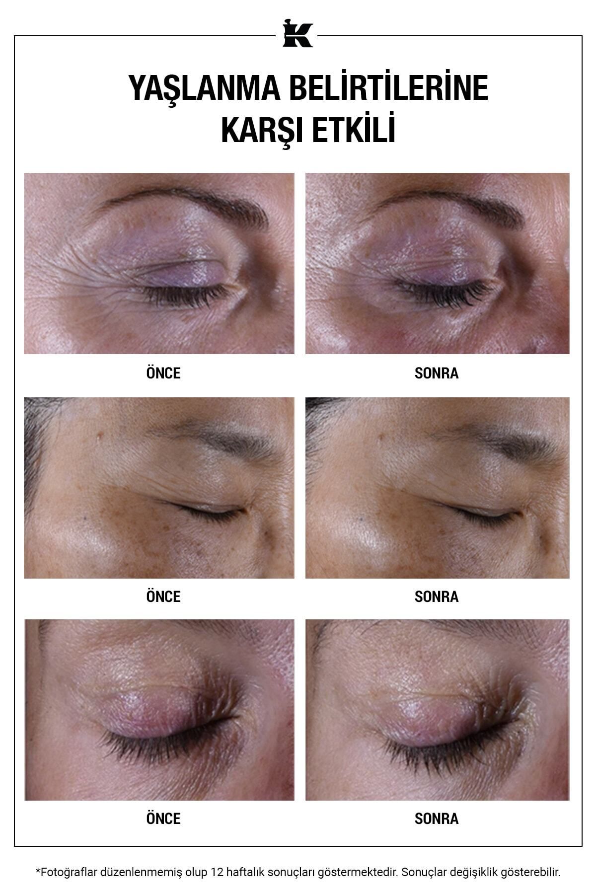 کرم دور چشم ضد تصفیه فوق العاده چند تصحیح حلقه و مراقبت از دایره تیره 14 میل Kiehl's