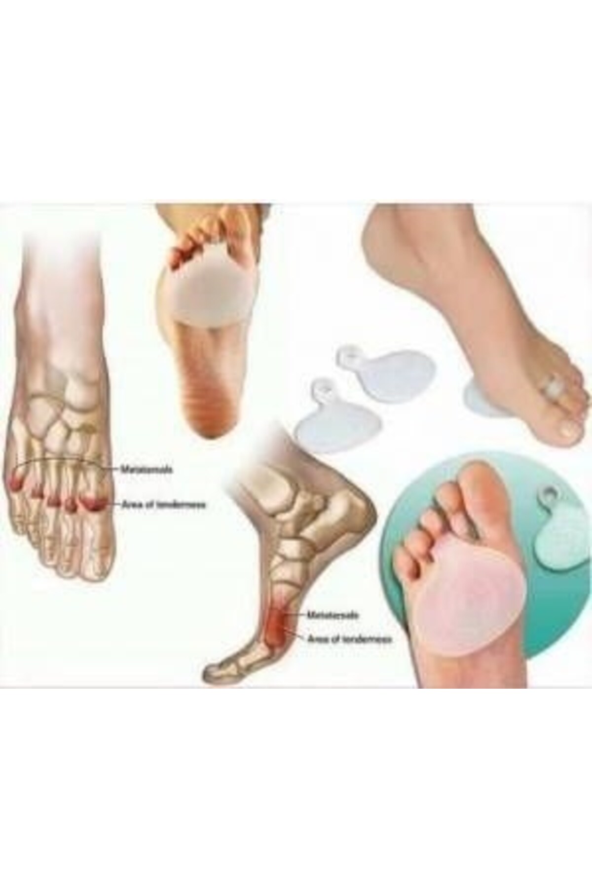 Ayak Taban Ped Parmağa Geçmeli Silikon Metatarsal Pedi Yüzük Nasir Önleyici Ped Ayak Alti Koruyucu-w 5