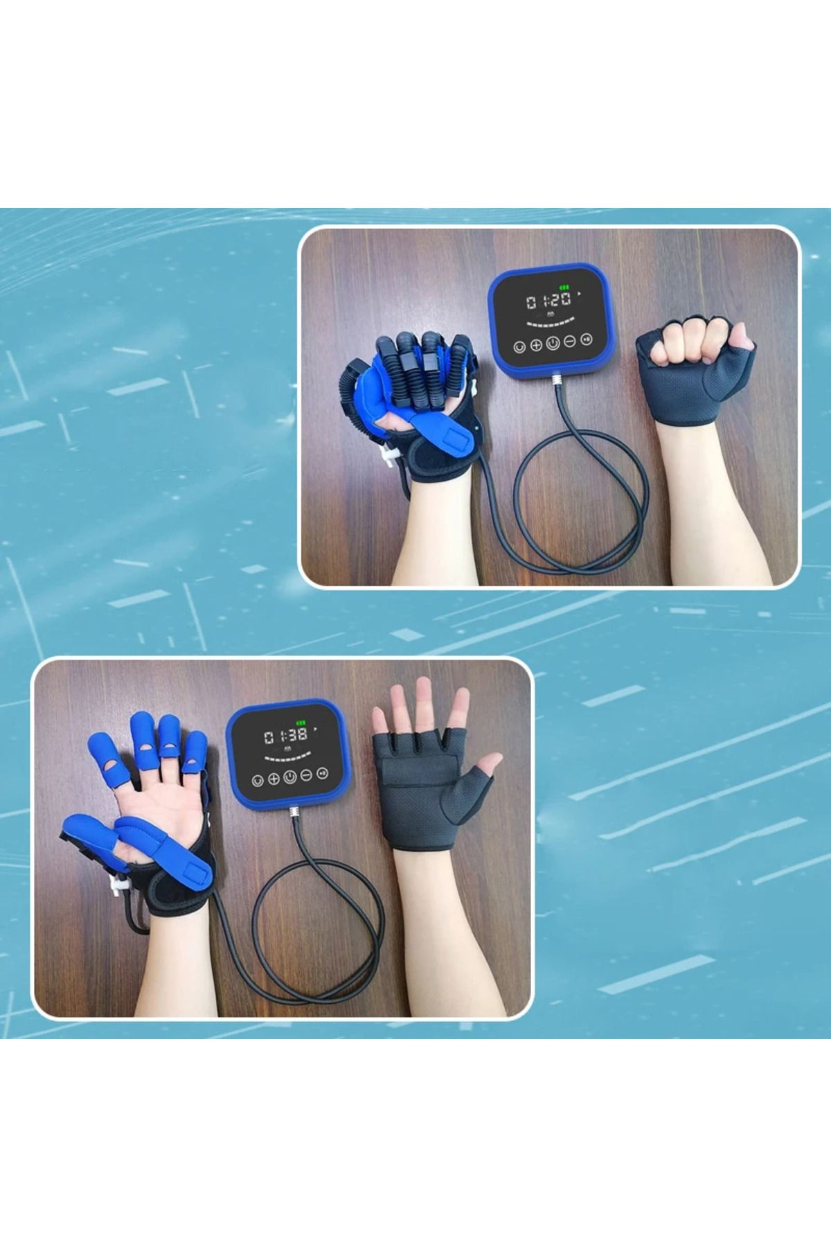 Fizyoterapi Cihazı: Sol ve Sağ El İnme Rehabilitasyon Robotu