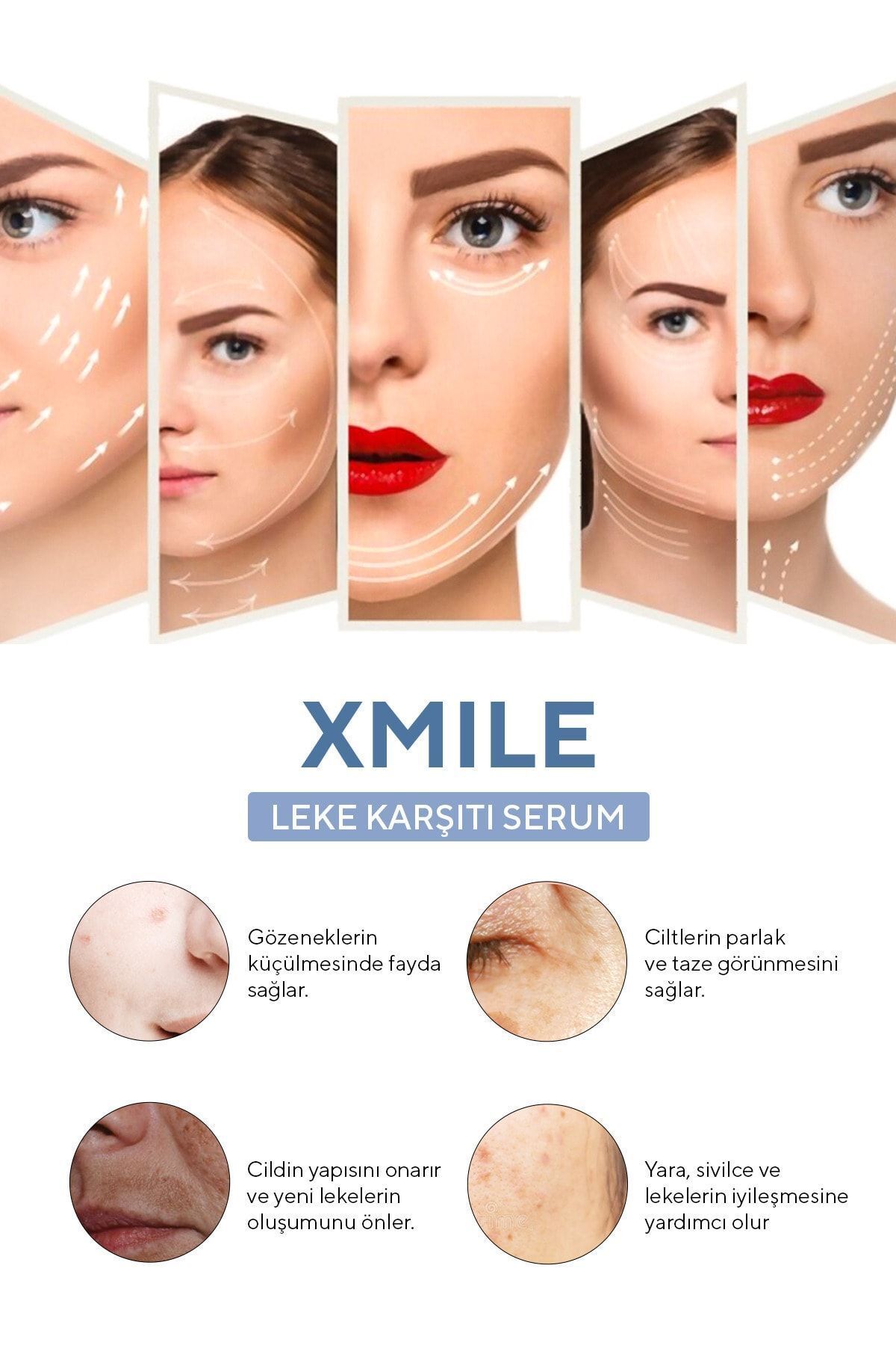 سرم ضد لک – اکولایزر تن رنگ و ضد تیرگی – 30 میلی لیتر Xmile