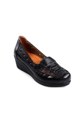 Ortapedik Comfort Siyah Hakiki Deri Yazlık Bayan Ayakkabı ST01206