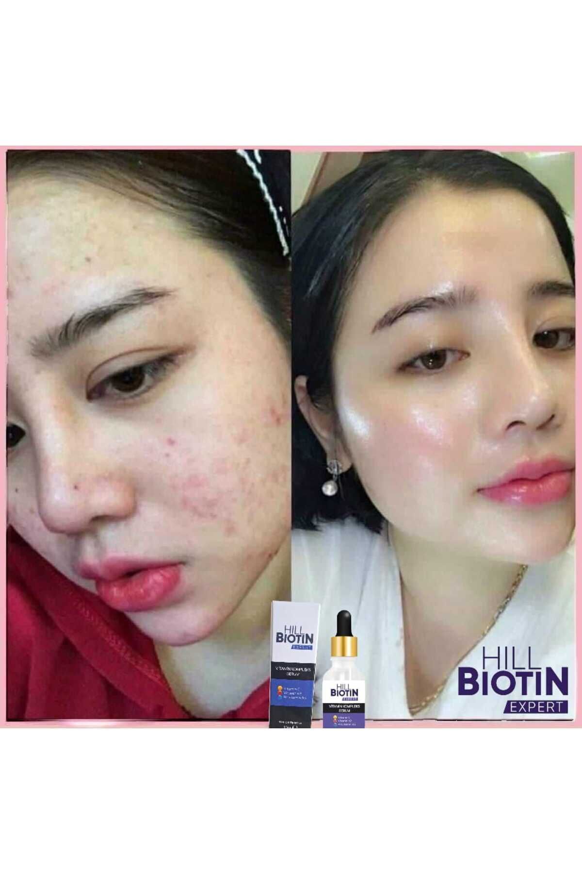 سرم پوست   HILL BIOTIN EXPERT | HILL573705 اورجینال - تصویر 2