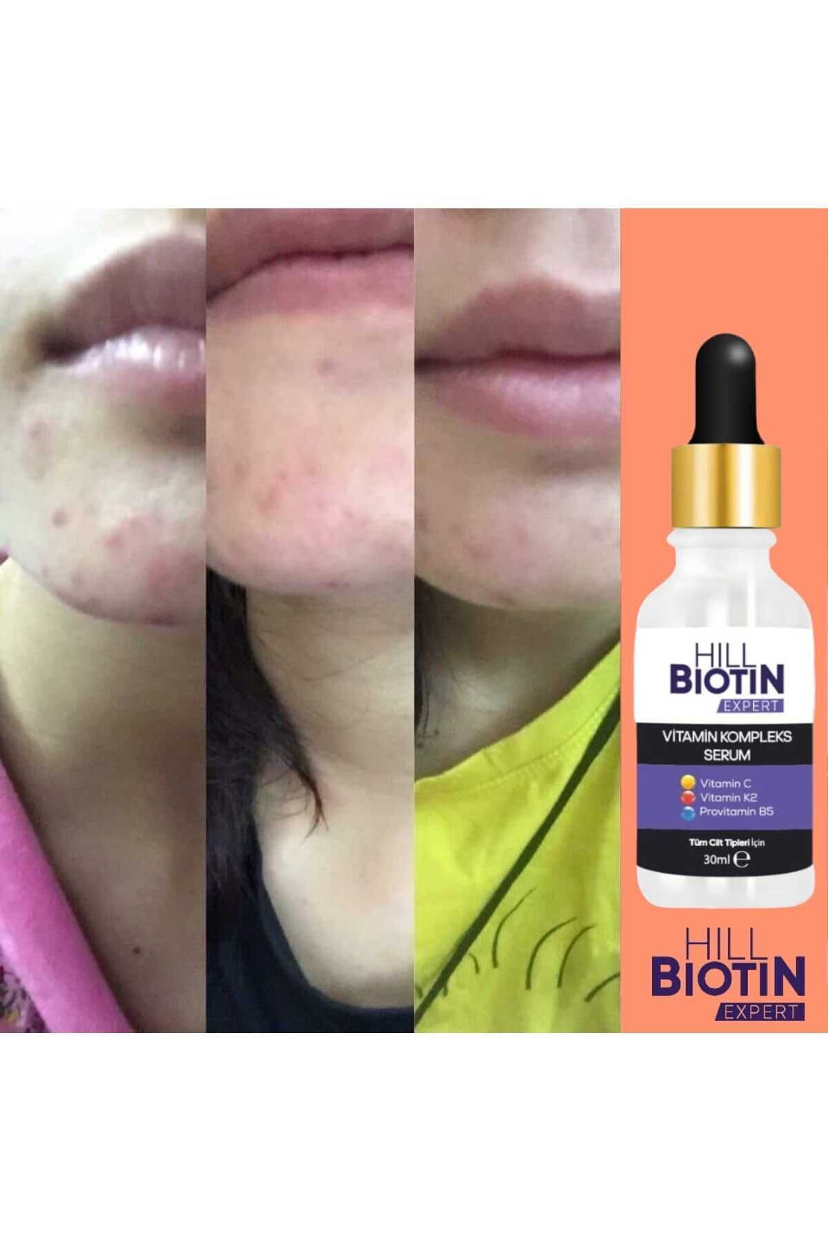 سرم پوست   HILL BIOTIN EXPERT | HILL573705 اورجینال - تصویر 3